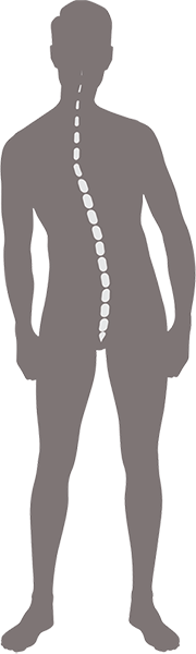 scoliosis